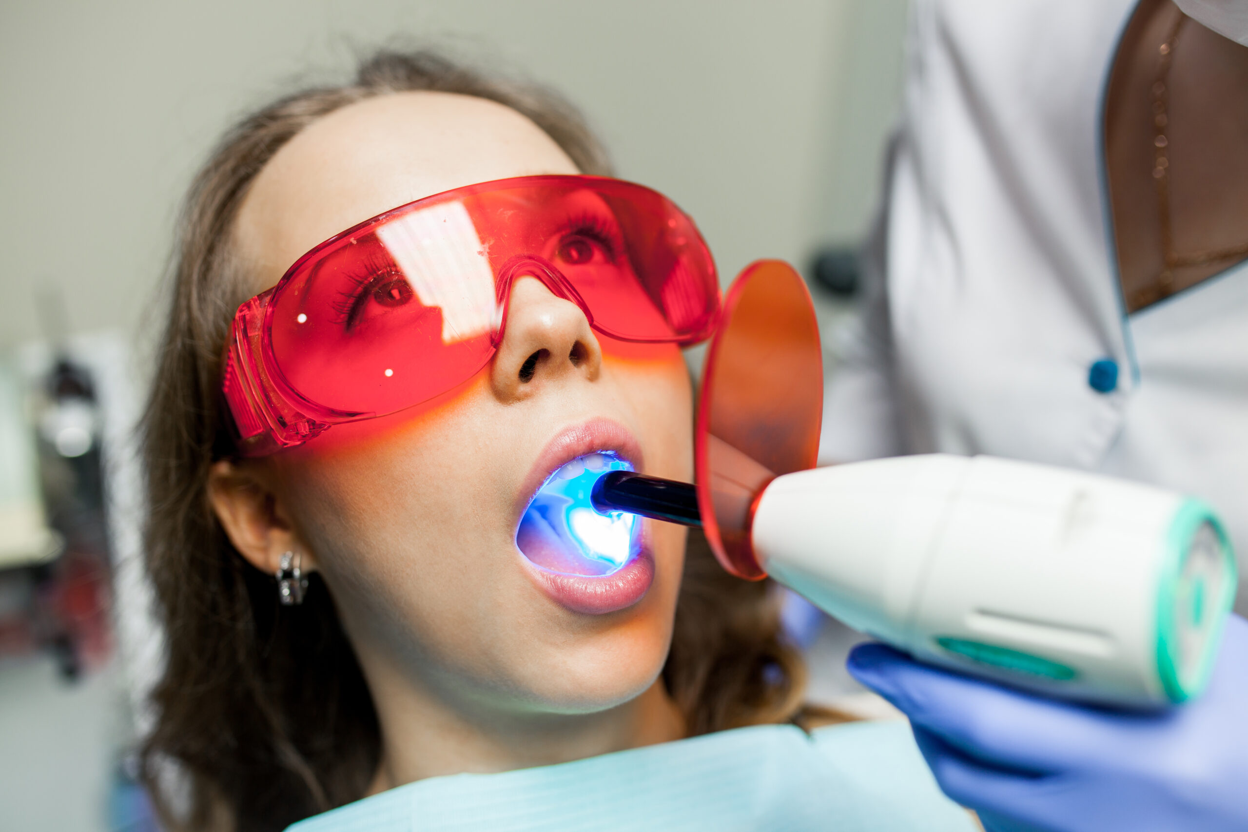 Laser Teeth Whitening | Healthy Dental Crown Process | Star Dental | Dental Wellness