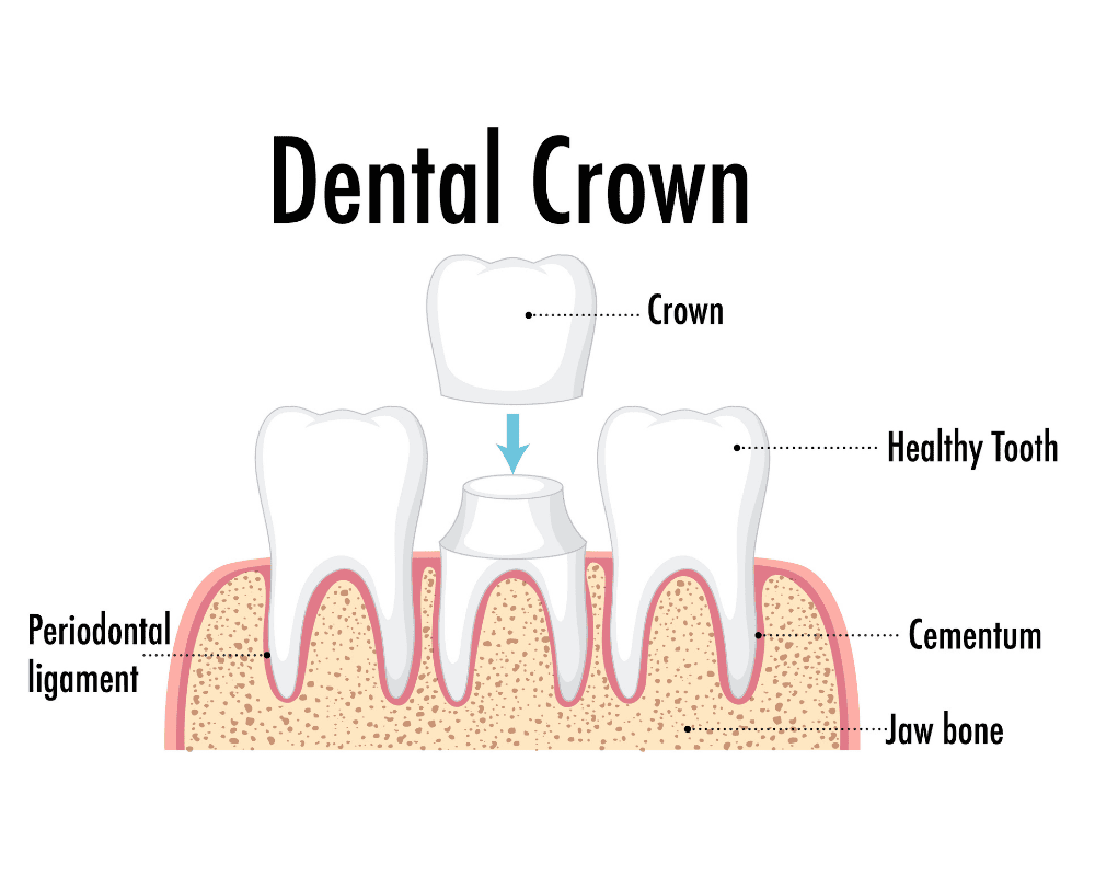 Crown Process