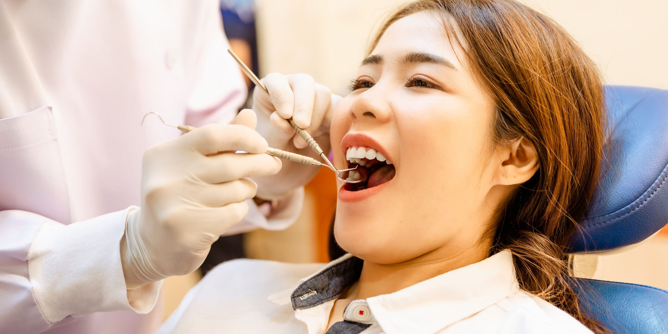 Dental Fillings