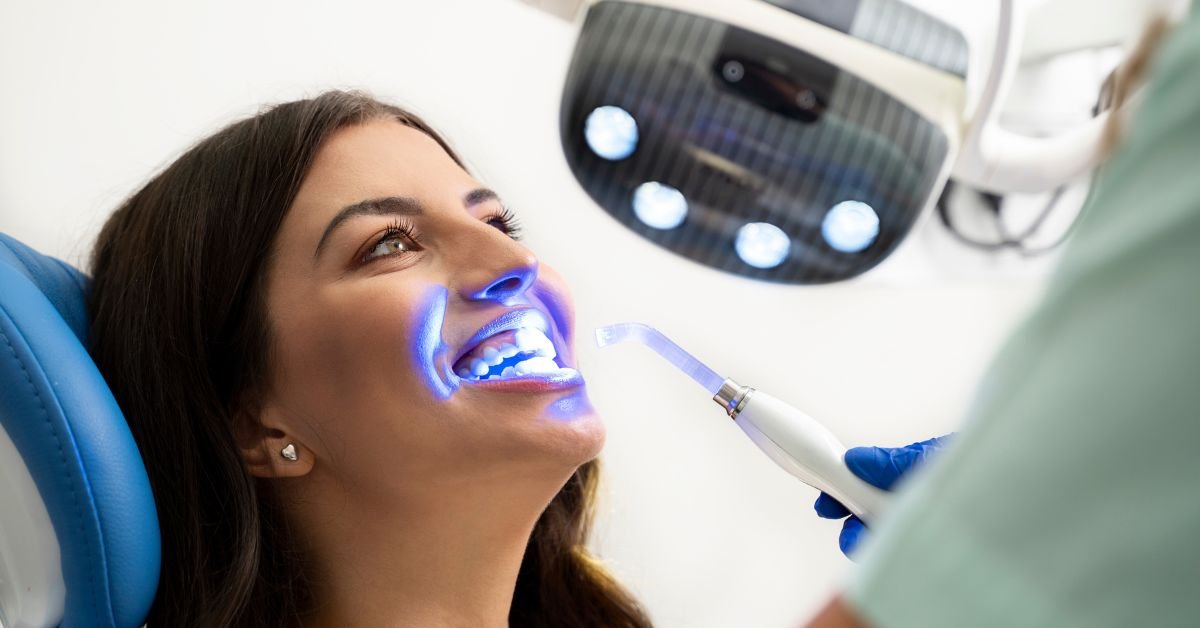 Best Teeth Whitening in Calgary