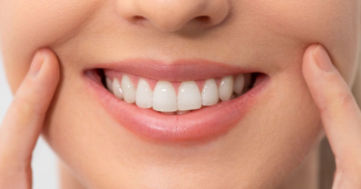 Best Teeth Whitening in Calgary