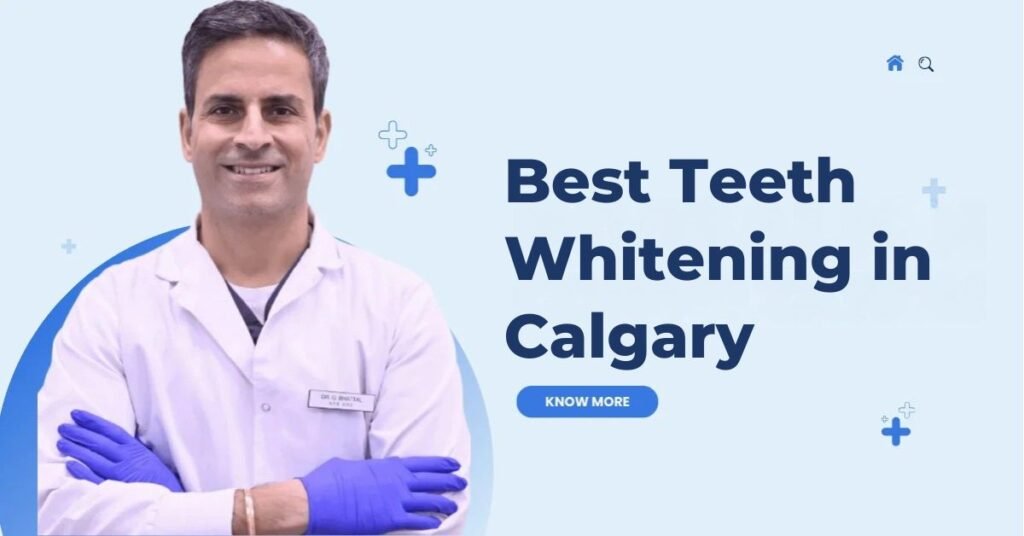 Best Teeth Whitening in Calgary