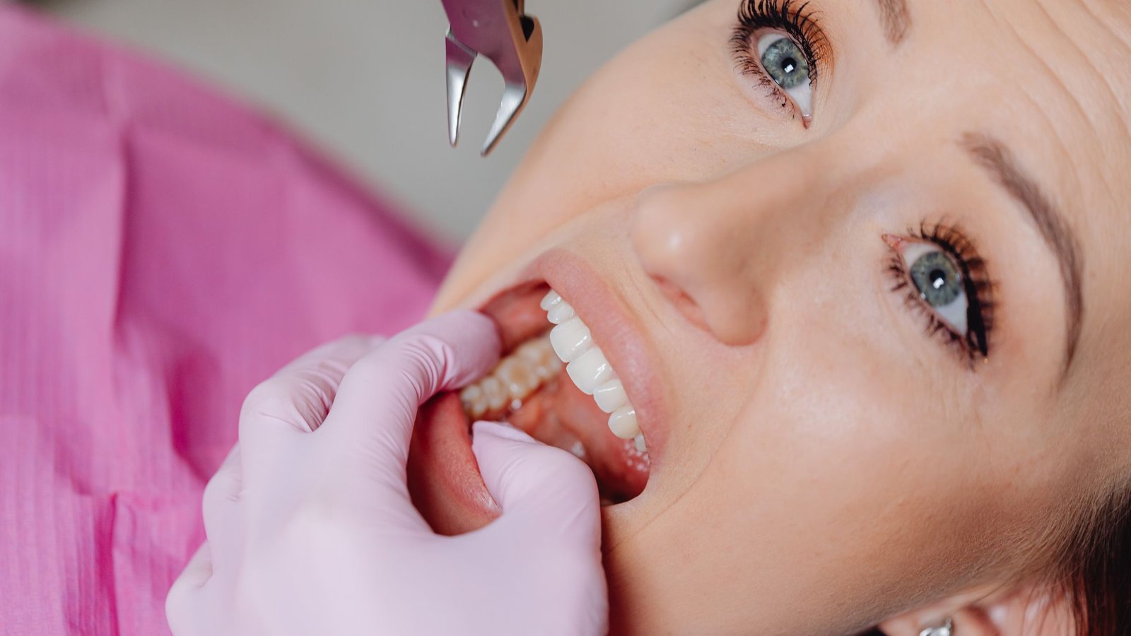 Best Tooth Extraction